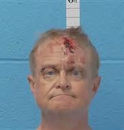 Man aged 50-60 years old with sandy brown/blonde hair with a slight frown. Has an injury to his forehead as a result of a fall.